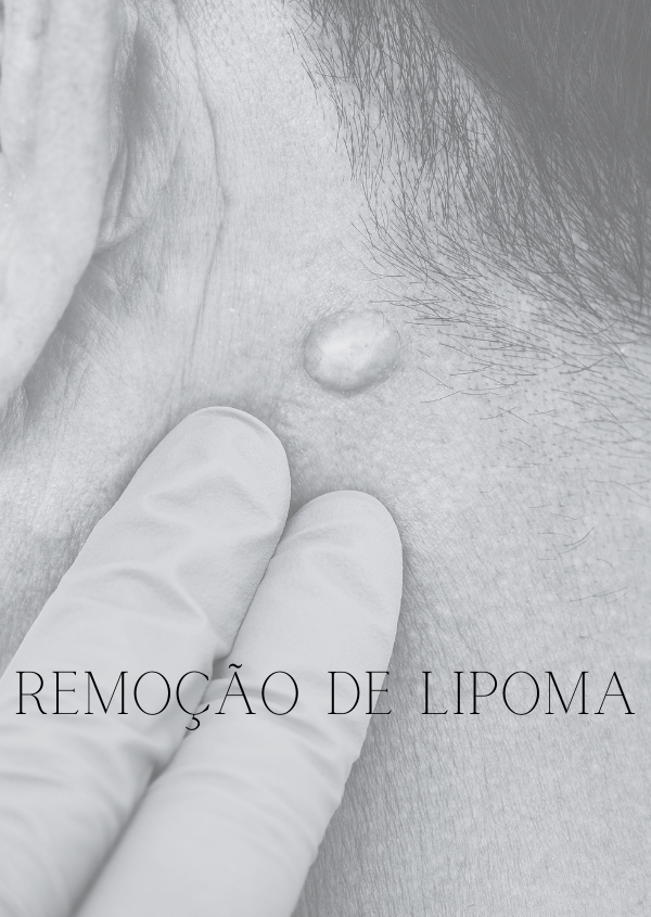 LIPOMA