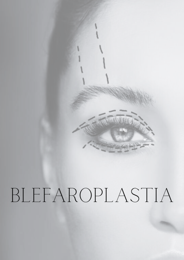 Blefaroplastia