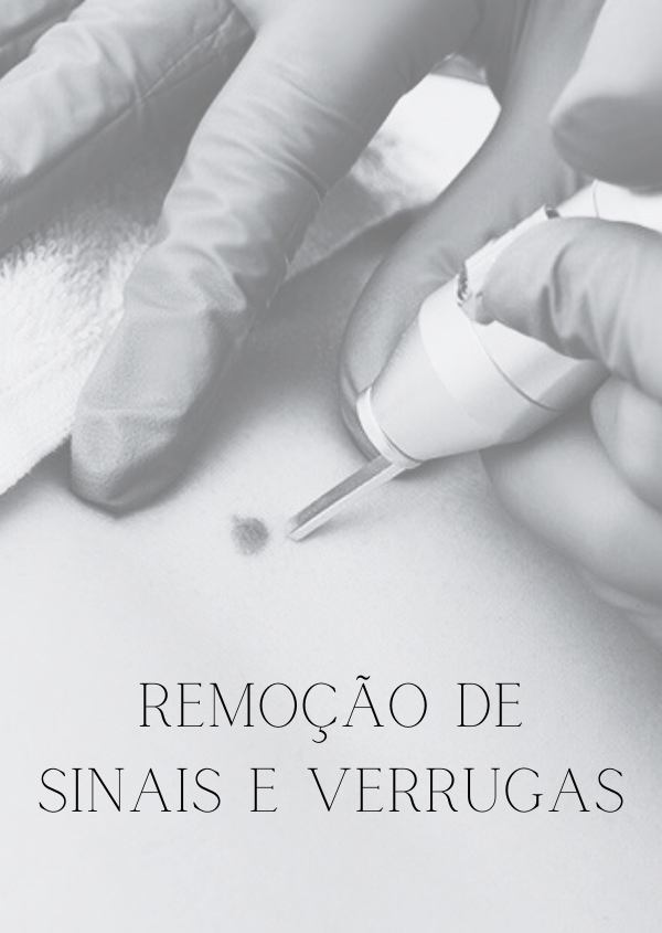 REMOÇÃO DE SINAIS E VERRUGAS