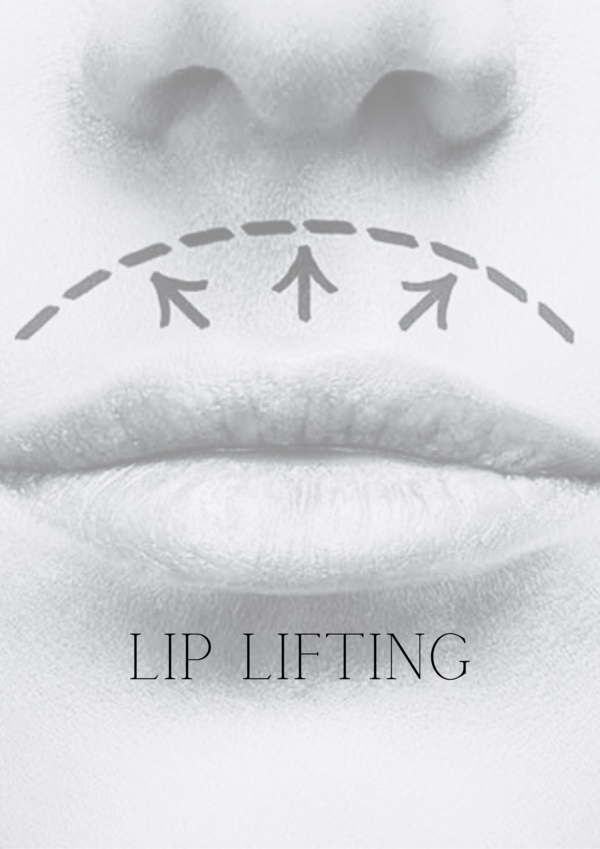 LIP LIFTING