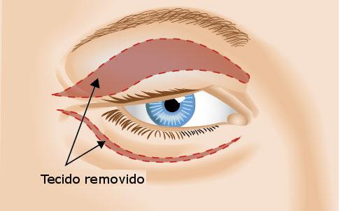 Cirurgia Plástica Facial