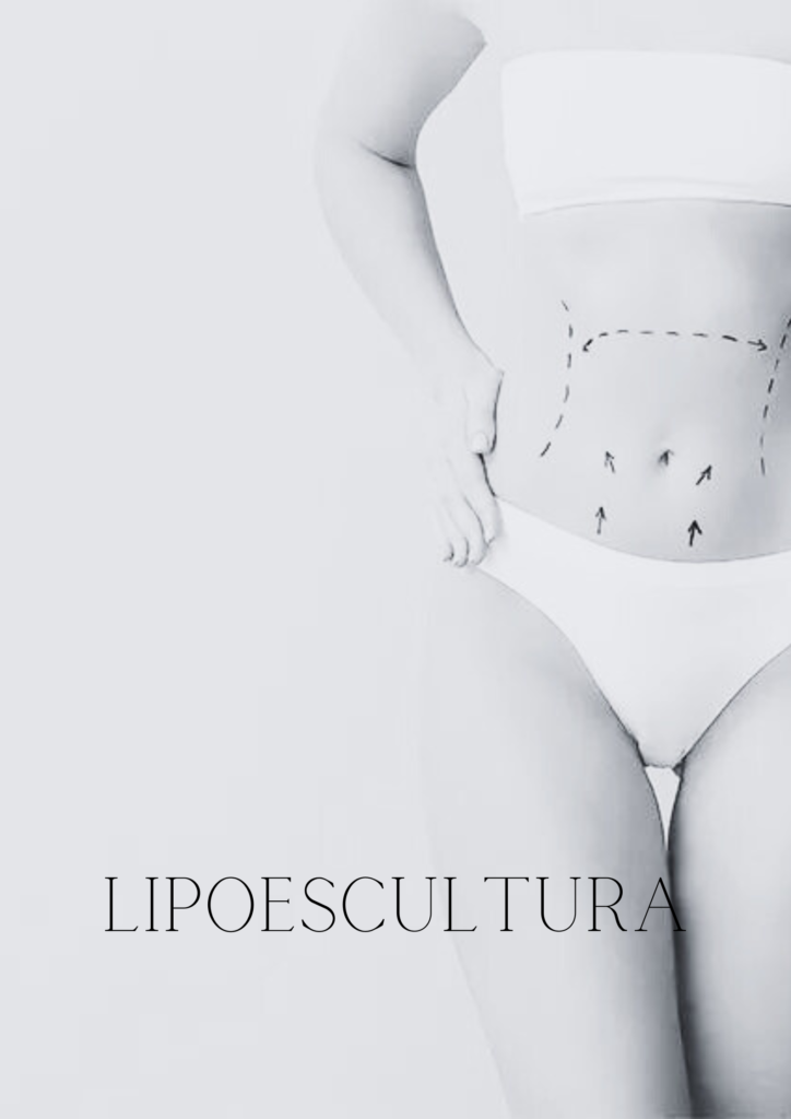 lipoescultura