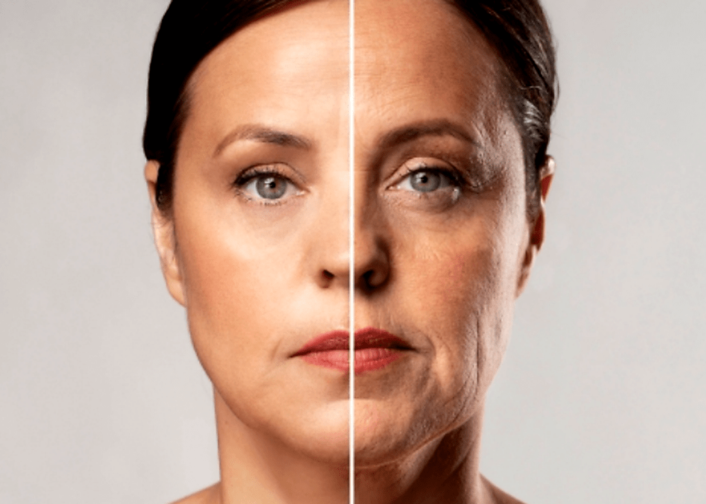 lifting facial em imperatriz